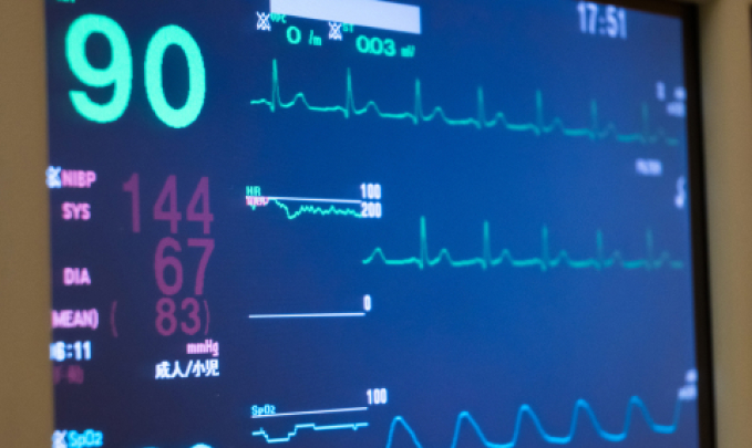 生体情報モニター